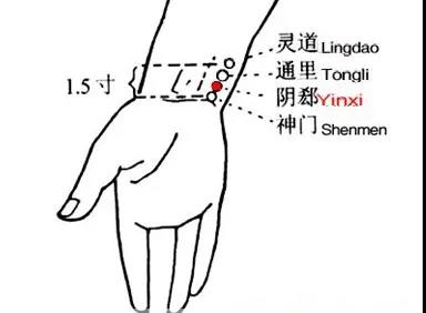 睡覺愛出汗，艾灸這幾個(gè)穴位