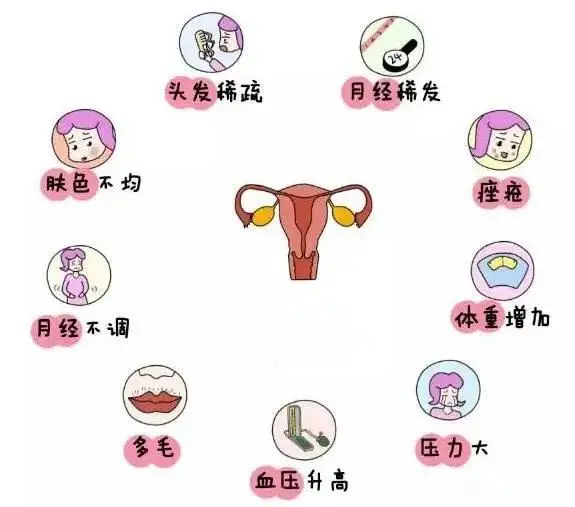 10個(gè)女人就有1個(gè)患多囊！被它纏上不要怕，艾灸幫你調(diào)“多囊”！